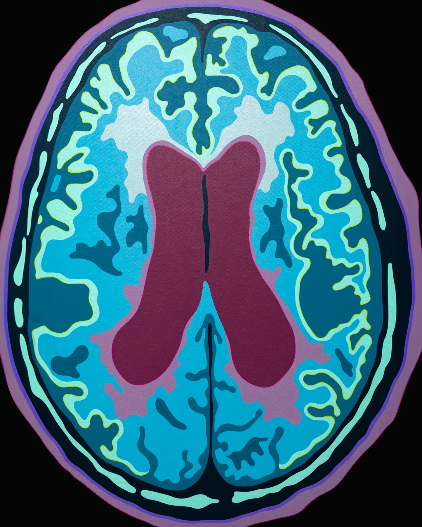 "Ventricular" Print