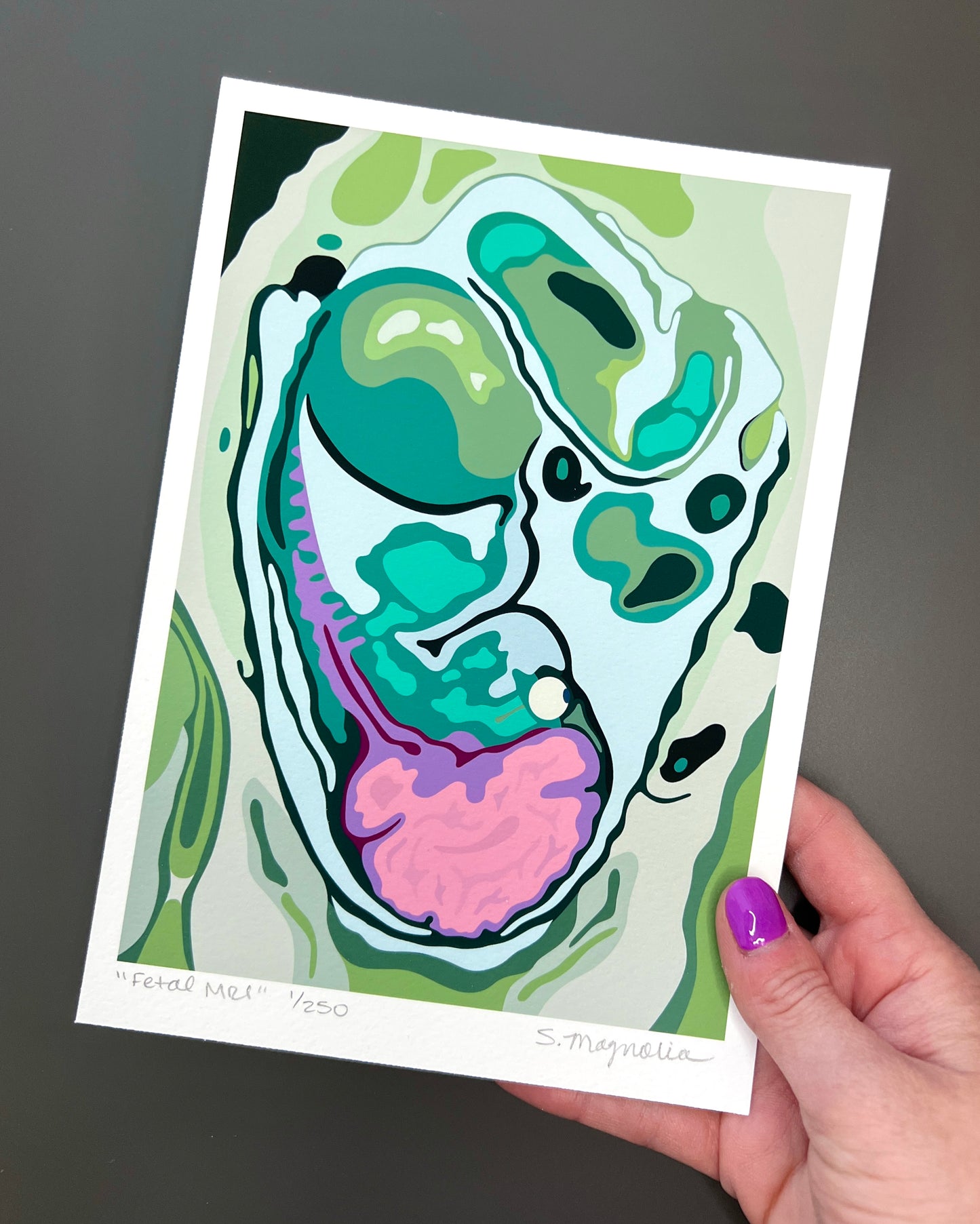 "Fetal MRI" Print