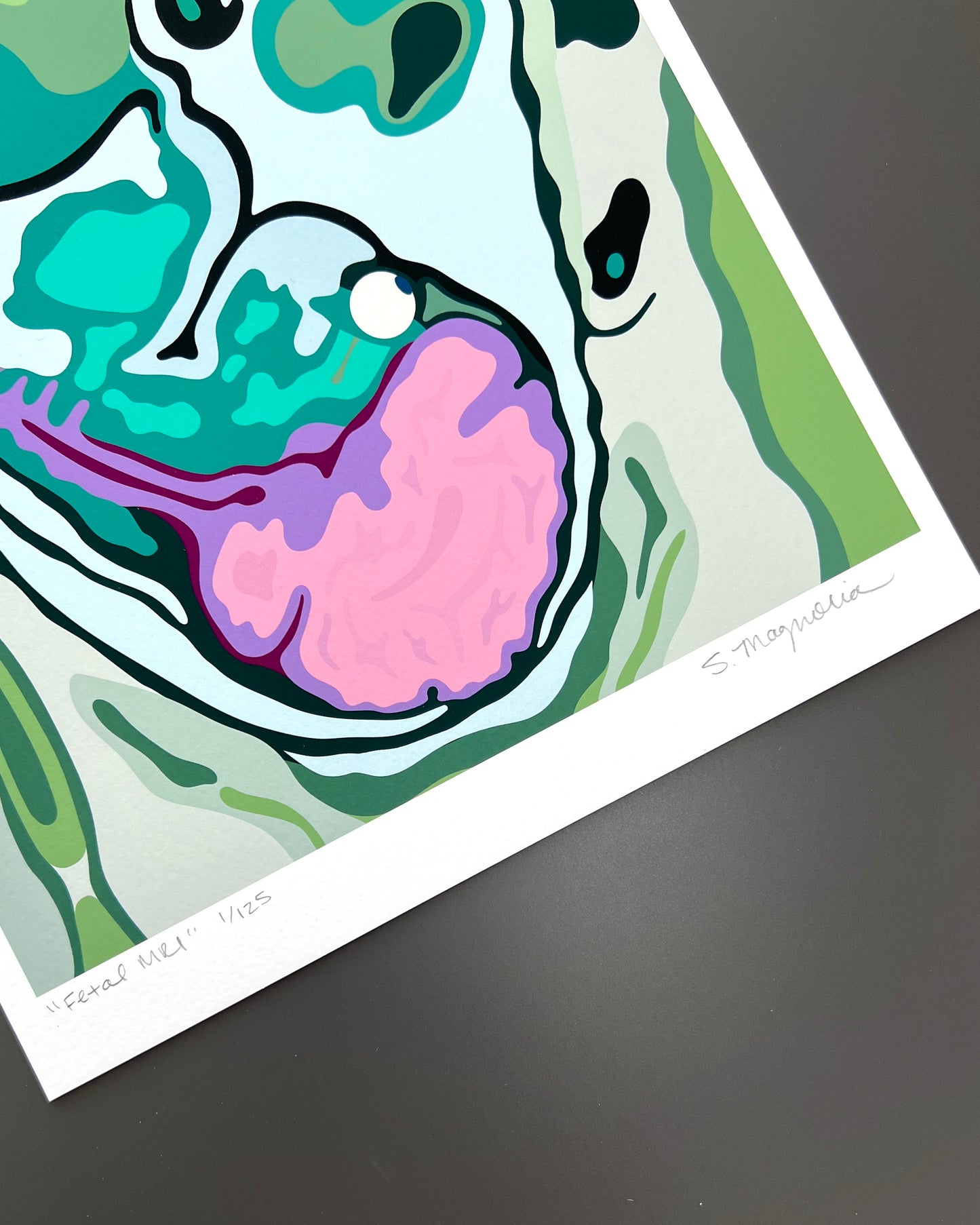 "Fetal MRI" Print