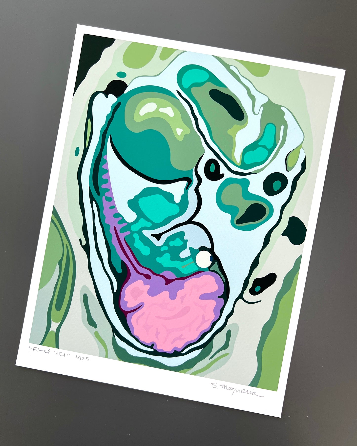 "Fetal MRI" Print