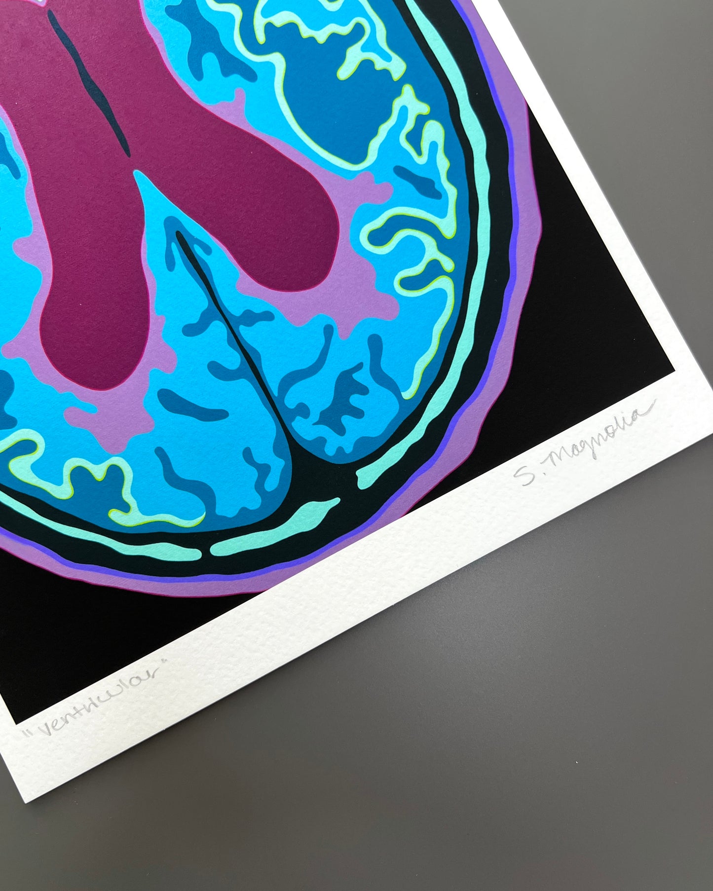 "Ventricular" Print