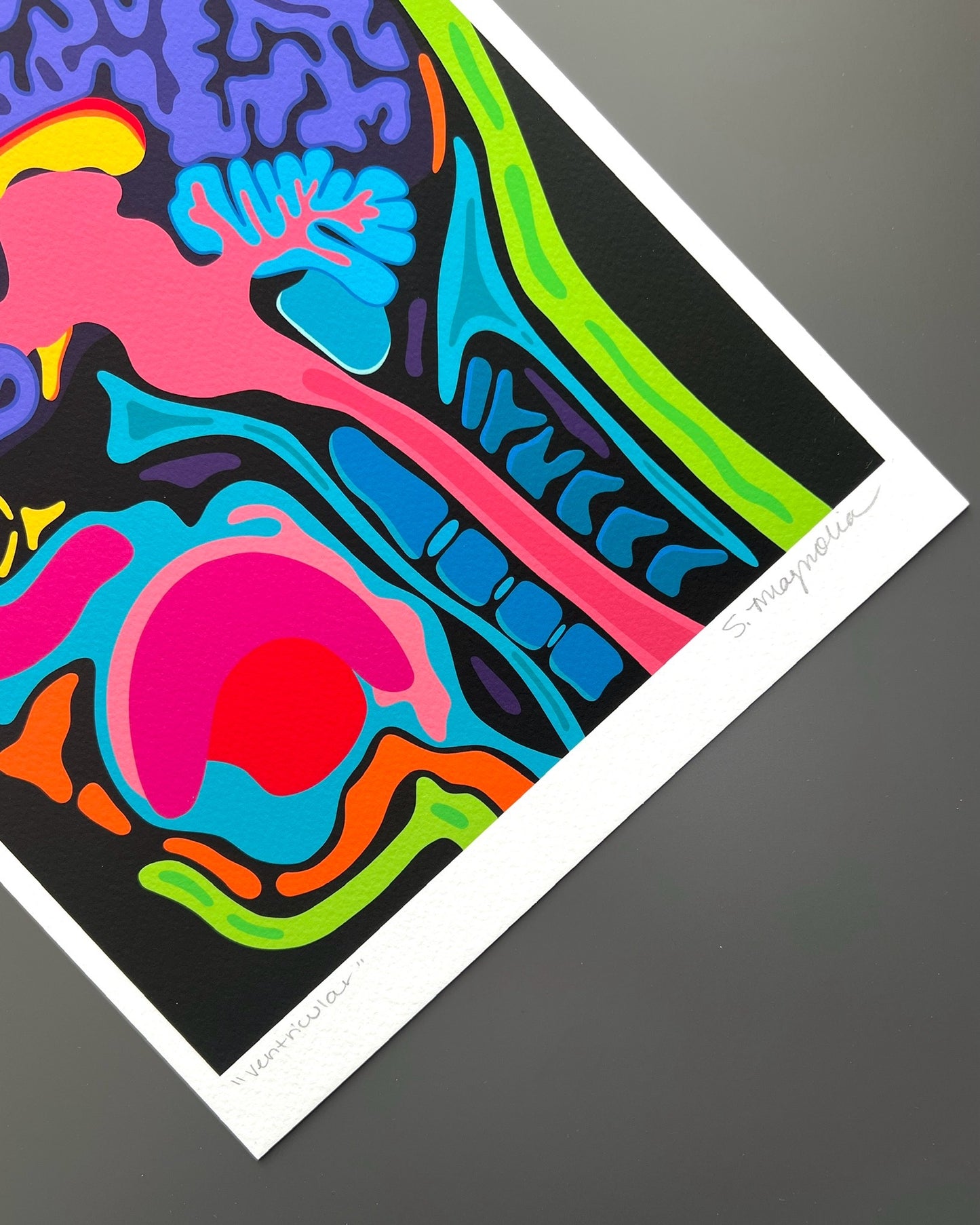 "Sagittal" Print