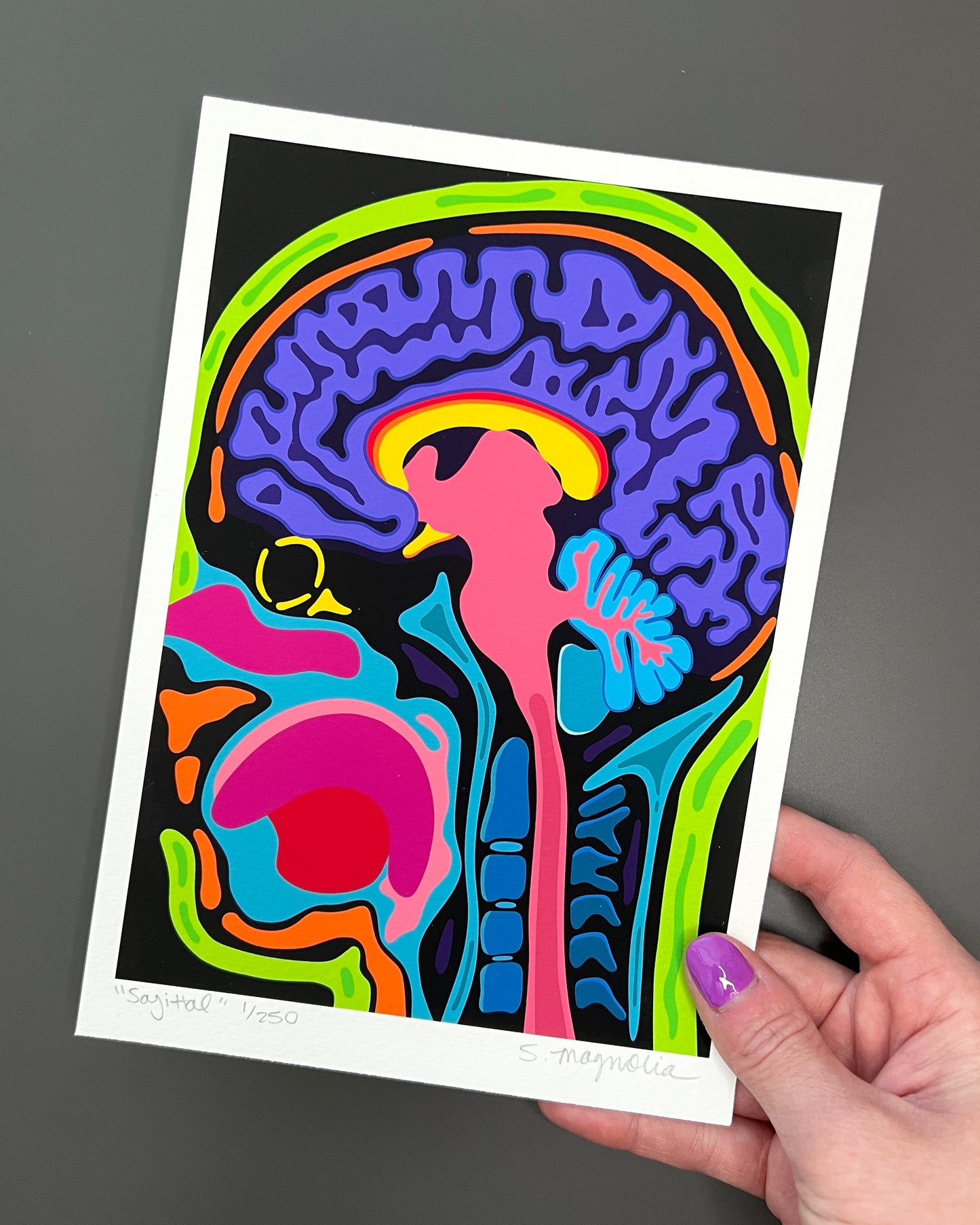 "Sagittal" Print
