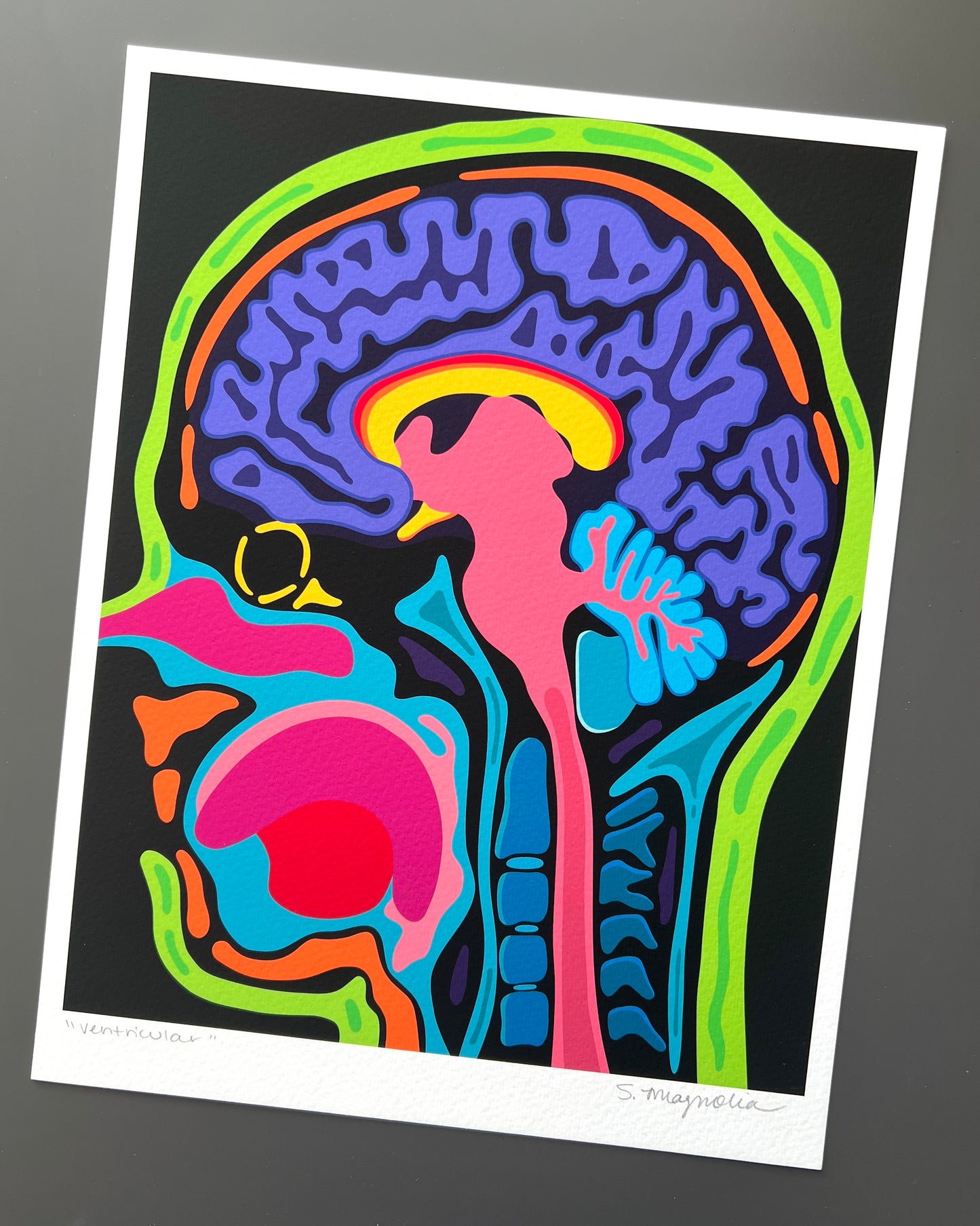 "Sagittal" Print