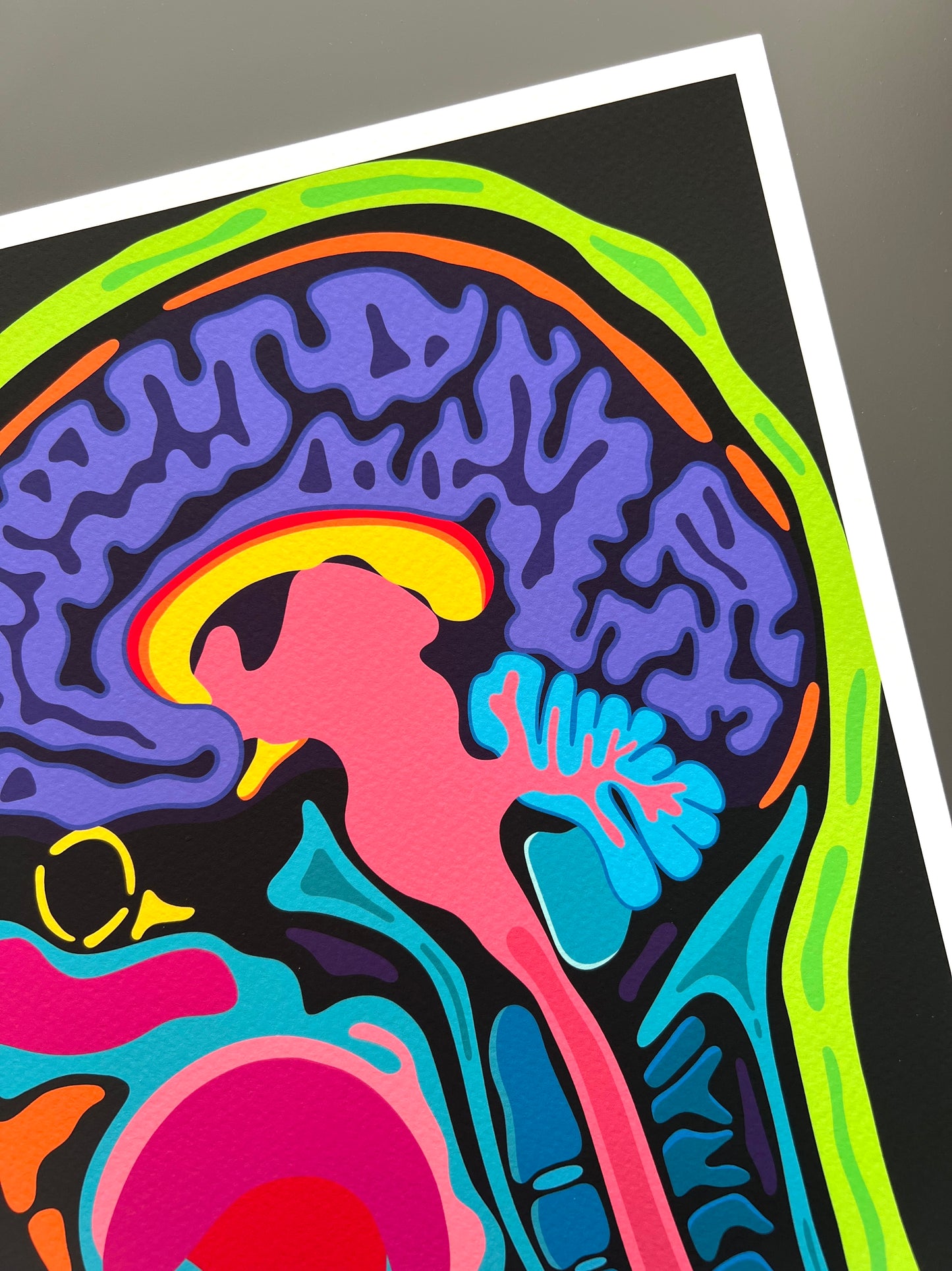 "Sagittal" Print
