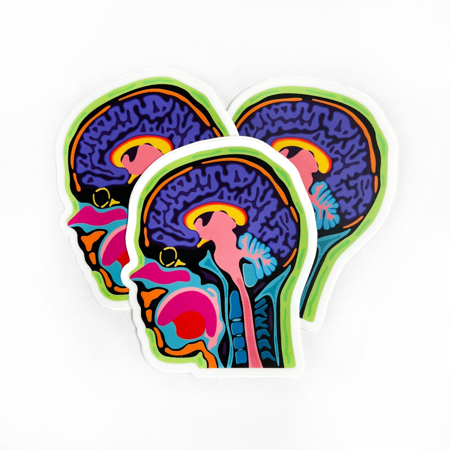 "Sagittal" Head MRI Sticker